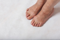 Many Types of Crooked Toes